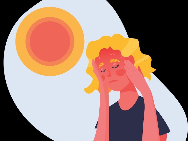 Heat stroke illustration