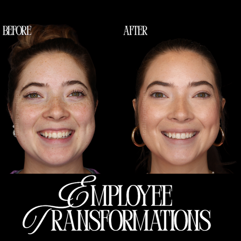 Before and After | Totality MediSpa